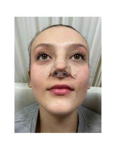 Retenedor de Nostril Nanovita + Cinta Quirúrgica Micropore