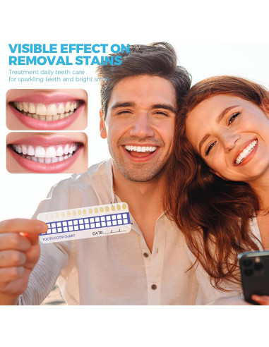 Kit Blanqueamiento Dental URSMILEKIT 16 LED Dientes Sensibles