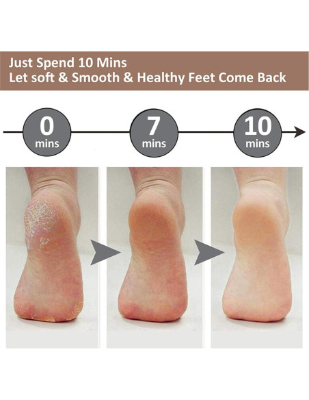 Removedor de Callos Eléctrico Exovan Rosa, 2 Velocidades Ajustables