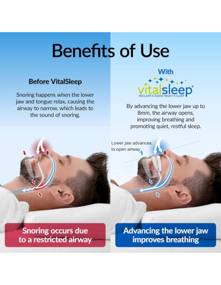 Dispositivo Bucal Antisnoring VitalSleep Ajustable - FDA