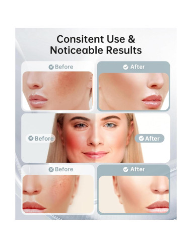 Masajeador Facial LED 7 Colores Baihui MJ-400 Rosa