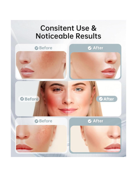 Masajeador Facial LED 7 Colores Baihui MJ-400 Rosa