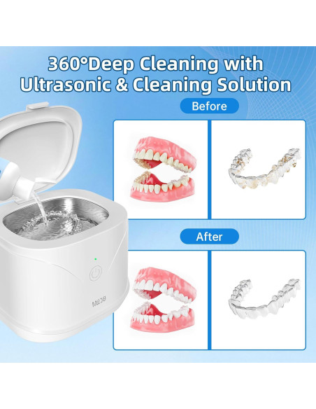 Limpiador Ultrasonico Bcom 240 ml para Retenedores y Joyería