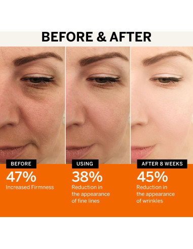 Suero Facial Antienvejecimiento Lupure Vitamina C 150ml