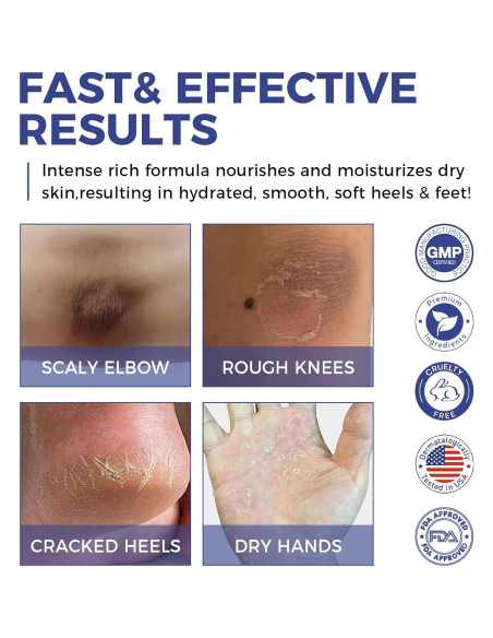 Crema de Urea OUKEYA 42% + Ácido Salicílico 2% - 2 Piezas