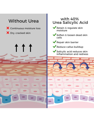 Crema de Urea OUKEYA 42% + Ácido Salicílico 2% - 2 Piezas