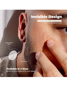 Parches Hidrocoloides RoselynBoutique para Granitos - 30 Unidades 2