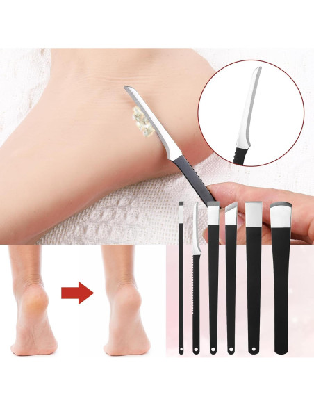 Kit de Remoción de Uñas Encarnadas LIQWEI 6 Piezas Acero Inoxidable