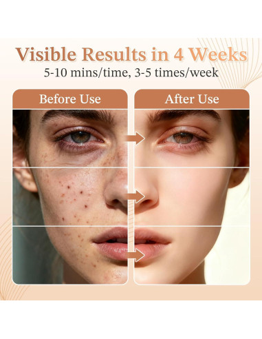 Máscara de Terapia de Luz Roja 850nm FDA - Belleza Facial