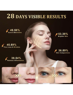 Máscara de Terapia de Luz LED Lovsheme para Rejuvenecimiento Facial 2