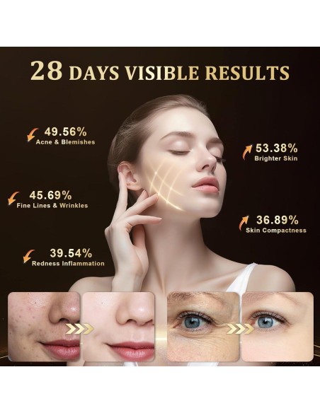 Máscara de Terapia de Luz LED Lovsheme para Rejuvenecimiento Facial