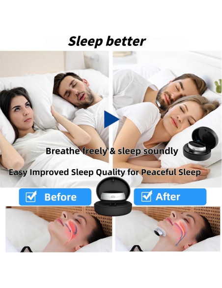 Dispositivo Antironquidos Donpidd Z3 Pro - 3 Niveles Ajustables