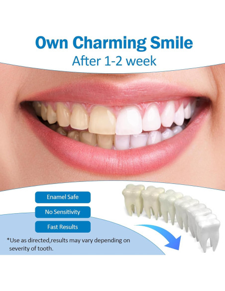 Blanqueamiento Dental Hedhedhed Bolígrafo 14.4x7.1cm