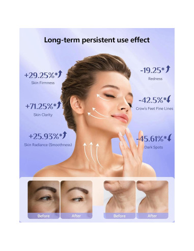 Máscara de Terapia de Luz LED Tinkoola para la Cara 630nm 830nm