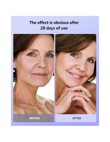 Máscara de Terapia de Luz LED Tinkoola para la Cara 630nm 830nm