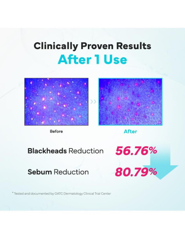 Aceite Limpiador Facial SAM'U Galacto 200 ml - Hidratante y Suave