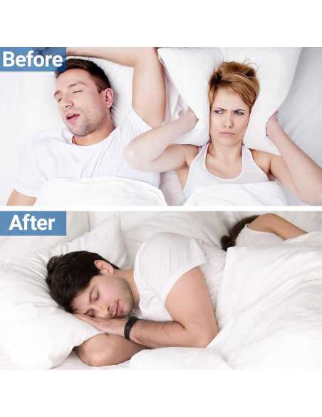 Tiras Nasales iShanCare 30 Conteo para Mejor Sueño y Respiración