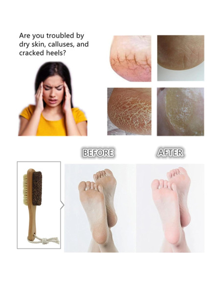 Piedra Pómez Natural YIOYOODA con Cepillo para Pies - Exfoliador Doble Cara