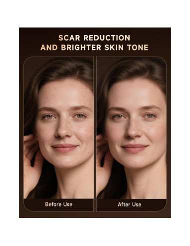 Máscara de Terapia de Luz Roja BMONATY SKB-2418 272 LEDs