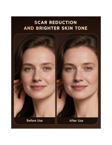 Máscara de Terapia de Luz Roja BMONATY SKB-2418 272 LEDs