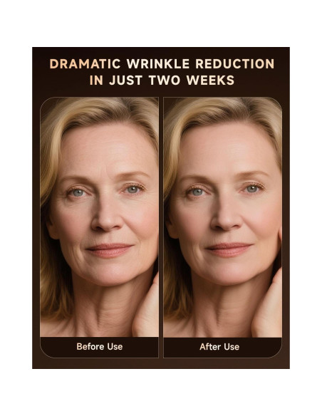 Máscara de Terapia de Luz Roja BMONATY SKB-2418 272 LEDs