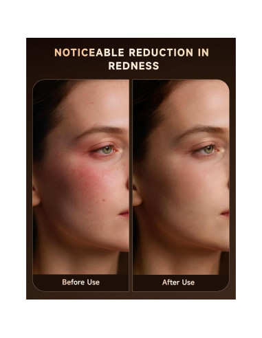 Máscara de Terapia de Luz Roja BMONATY SKB-2418 272 LEDs