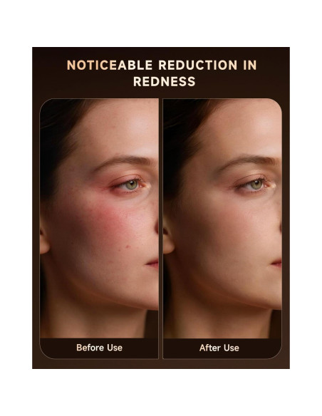 Máscara de Terapia de Luz Roja BMONATY SKB-2418 272 LEDs