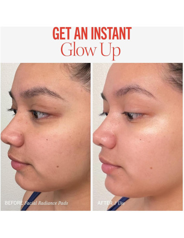 Almohadillas Exfoliantes Faciales First Aid Beauty 28 Unidades