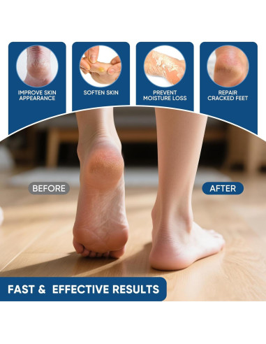 Crema de Urea 40% VREKEF con Ácido Salicílico 2% para Pies