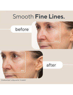 Máscara TheraFace LED Facial Antienvejecimiento 18x20cm 2