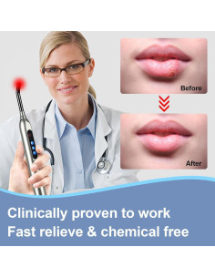 Dispositivo Terapia Luz Roja LONLIKE para Herpes y Ampollas 2