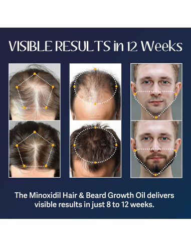 Kit Crecimiento Barba y Cabello Venanoci 60 ml - 5% Minoxidil