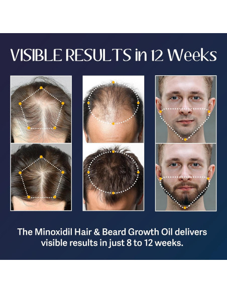 Kit Crecimiento Barba y Cabello Venanoci 60 ml - 5% Minoxidil