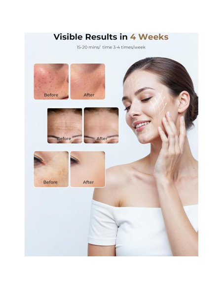 Máscara de Terapia de Luz LED Shenzhen Eyco E106A 7 Modos