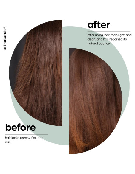 Champú ArtNaturals 473ml - Aceite de Árbol de Té Puro - Anticaspa