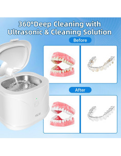 Limpiador Ultrasonico Bcom 240 ml para Retenedores y Joyería 2