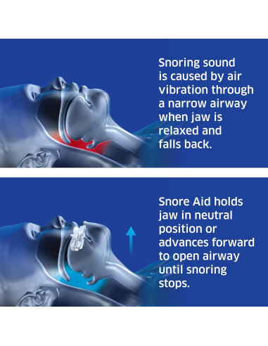 Dispositivo Antirronquidos SleepRight - Ajustable y Cómodo
