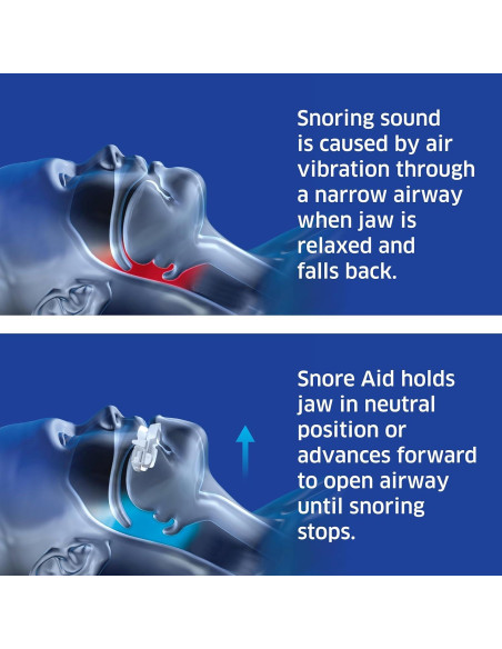 Dispositivo Antirronquidos SleepRight - Ajustable y Cómodo