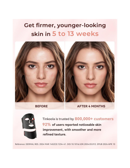 Máscara de Luz LED Tinkoola para Cara y Cuello - Negro