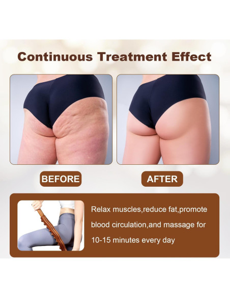 Bastón de Masaje de Madera para Drenaje Linfático 60 cm