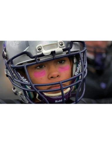 Barra Negra para Ojos DALVGFN Rosa Brillante 6.86cm Anti-reflejo