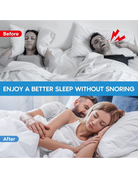 Válvulas Nasales Antisnoring KinomiYa - 8 Piezas Reutilizables