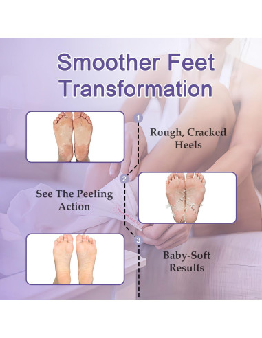 Mascarilla Exfoliante para Pies Genérico - 5 Paquetes con Urea y Lavanda