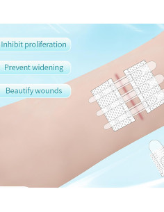 Kit de Cierre de Heridas Mariposa 6x8cm Vendas Autoadhesivas 2