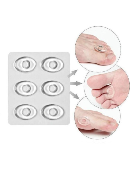 Anillos de Gel Ovalados Transparentes SYBL - 36 Pcs para Callos