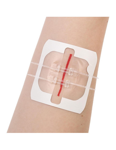 Cierres de Heridas LotFancy 4 Unidades Estériles Primeros Auxilios