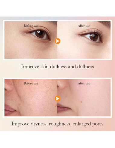 Kit de Cuidado Facial Hidratante Deepmind 6 Piezas Vitamina C