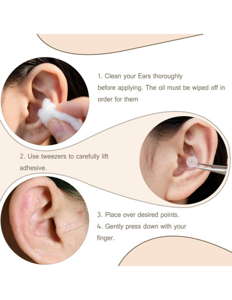 Kit de Acupuntura para Oído Genérico 140 Piezas con Herramientas