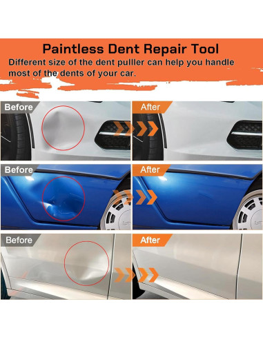 Extractor de Abolladuras Autodecora 3 Piezas con Ventosa