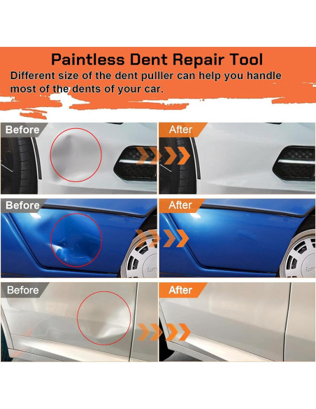 Extractor de Abolladuras Autodecora 3 Piezas con Ventosa